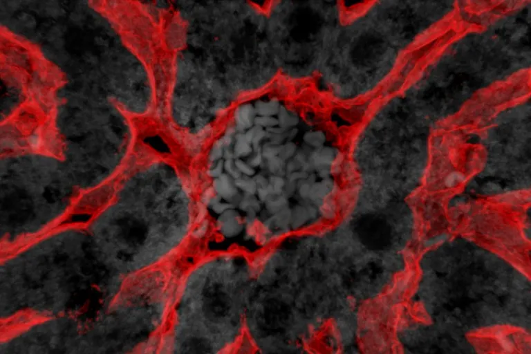 liver cells